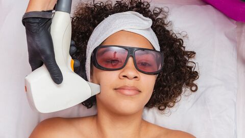 Eine Frau wird mit einem Laser im Gesicht behandelt